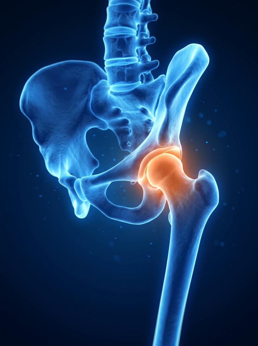 Illustration of the hip joint for robotic hip replacement in Hyderabad