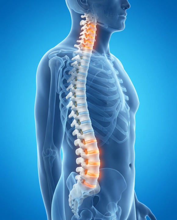3D illustration of the spine with painful neck and lower back discs highlighted