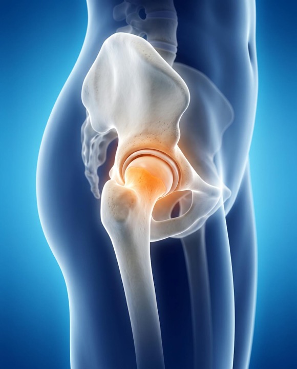 3D illustration of the hip joint with the femoral head highlighted
